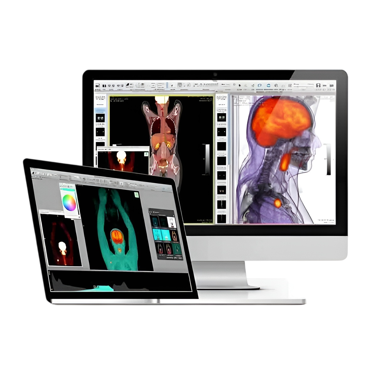 Sprzęt do diagnostyki obrazowej w nowoczesnej pracowni radiologicznej