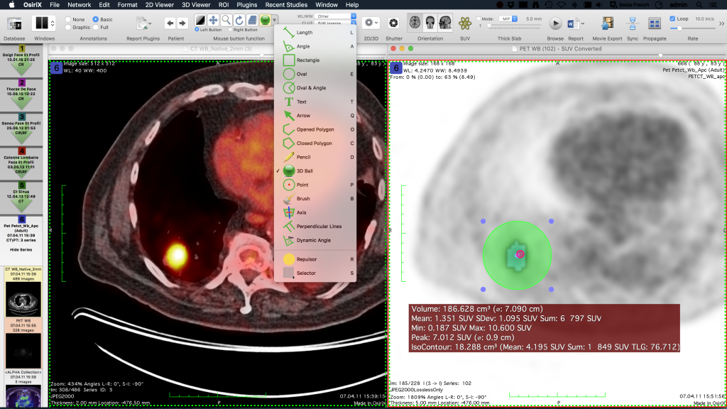 OsiriX MD — oprogramowanie DICOM