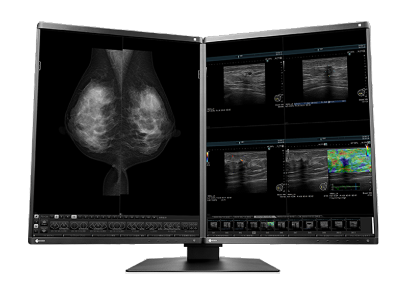Stacja Robocza Mammo — dwa monitory diagnostyczne 5MP