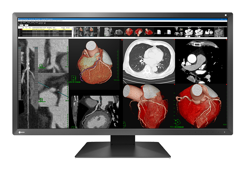 Stacja Robocza MR/TK — monitor diagnostyczny